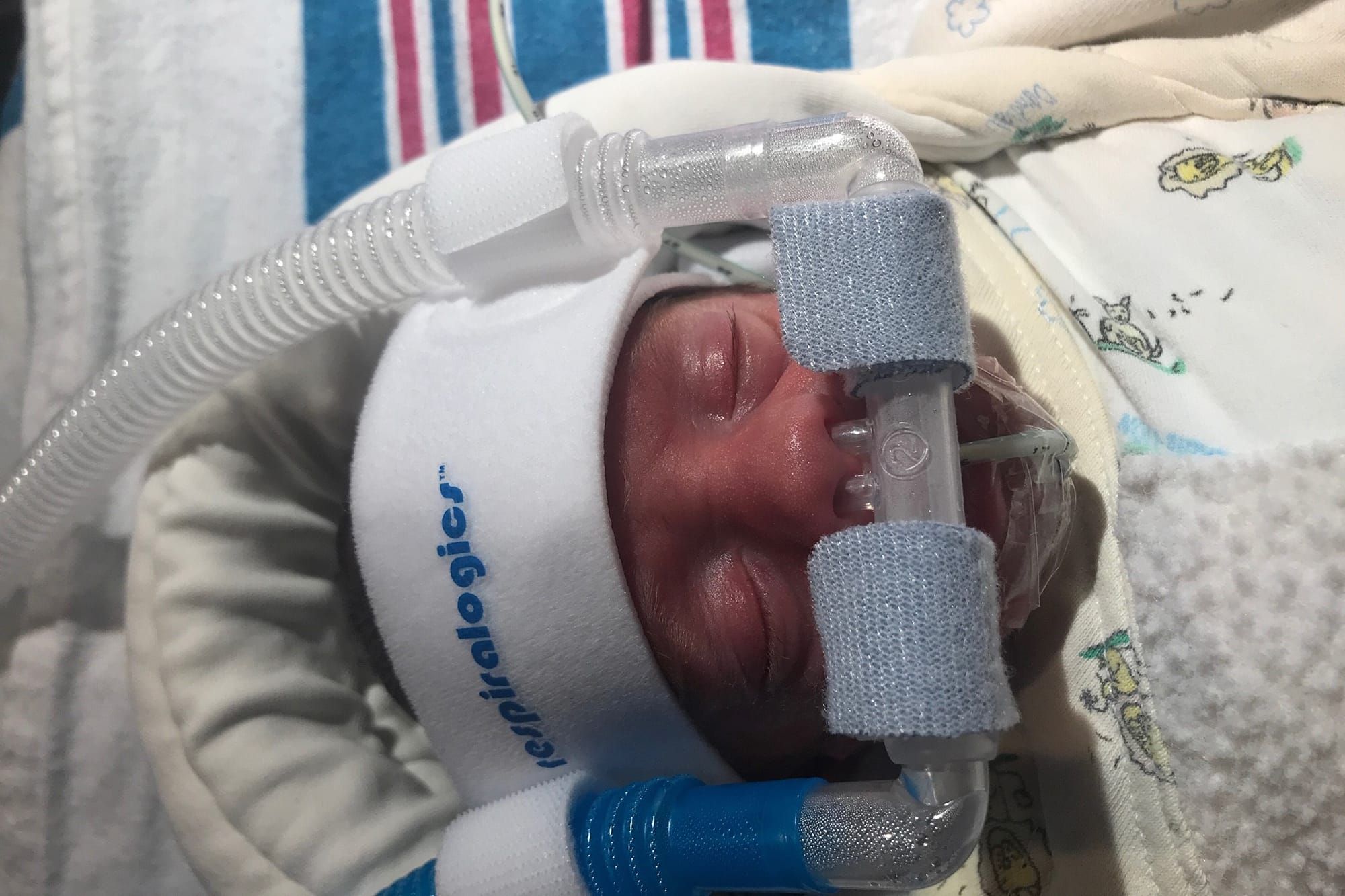 ESSENTIAL INSIGHTS INTO APNEA OF PREMATURITY: FROM DIAGNOSIS TO LONG-TERM PROGNOSIS