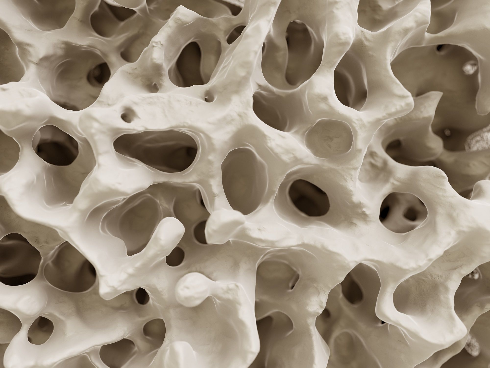 Osteoporosis: cuida tus huesos