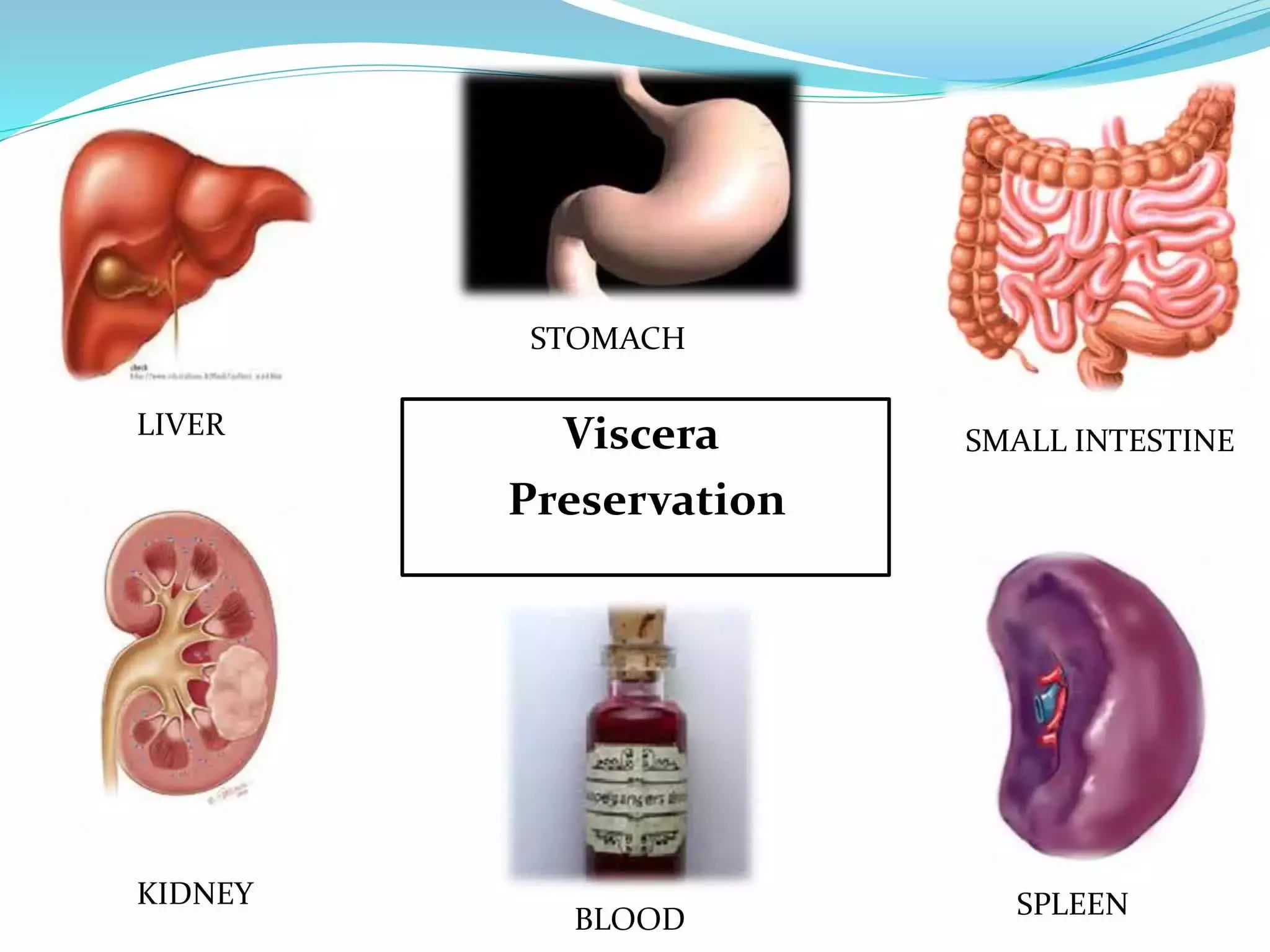 PRESERVATION OF VISCERA FOR CHEMICAL AND HISTOPATHOLOGICAL EXAMINATION