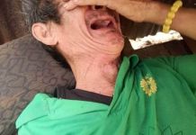 Cha bị tai biến nuôi 3 con nhỏ cần sự sẽ chia