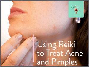 Using Reiki to Treat Acne and Pimples