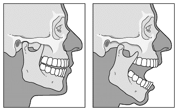 TEMPOROMANDIBULAR JOINT (TMJ) DISLOCATION AND RELATED ORAL-MAXILLOFACIAL CONDITIONS