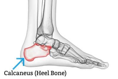 A diagram showing the calcaneus or heel bone