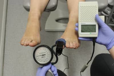 A podiatrist is performing a test of a patient's blood flow