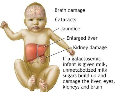 INBORN ERRORS OF METABOLISM: WHAT YOU SHOULD KNOW