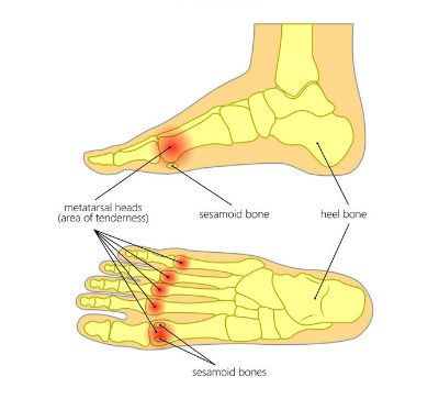 Tingling Toes - Causes and Treatment - Dynamic Podiatry