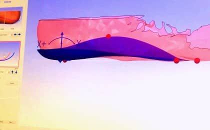 An orthotic being designed using CADCAM technology