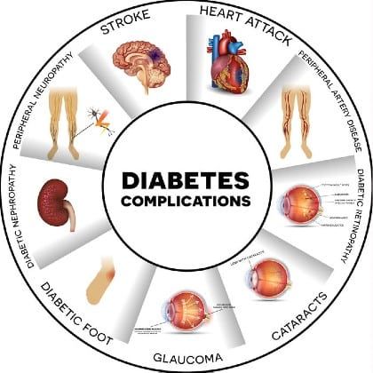 A diagram showing the affects on different body parts of diabetes
