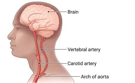 BLOOD VESSELS: ARTERIAL SYSTEM BLOOD VESSELS: ARTERIAL SYSTEM