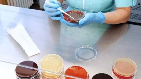 WHAT IS A SPUTUM CULTURE AND WHY IT MATTERS WHAT IS A SPUTUM CULTURE AND WHY IT MATTERS