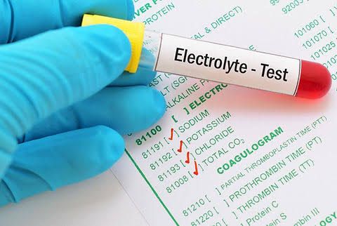 THE IMPORTANCE OF SERUM ELECTROLYTE ESTIMATION IN DIAGNOSING HEALTH CONDITIONS