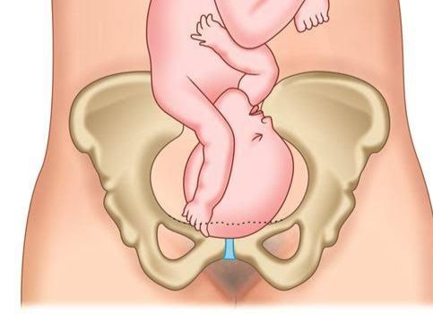 NAVIGATING COMPOUND PRESENTATION: TOP TIPS AND TECHNIQUES FOR SAFE DELIVERY