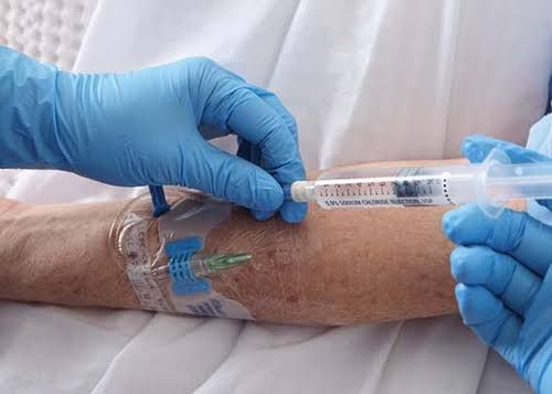 WHY FLUID AND ELECTROLYTE BALANCE MATTERS IN SURGERY WHY FLUID AND ELECTROLYTE BALANCE MATTERS IN SURGERY