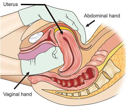 ULTIMATE GUIDE TO UTERINE COMPRESSION TECHNIQUES FOR POSTPARTUM HEMORRHAGE