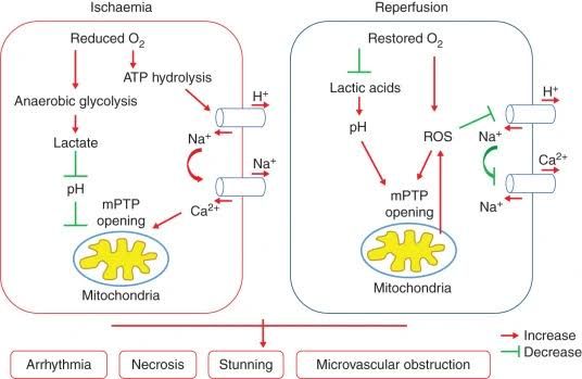 UNDERSTANDING ISCHEMIA AND REPERFUSION INJURY