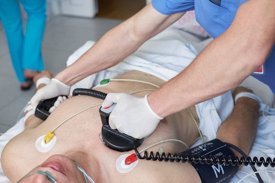 DEFIBRILLATION TECHNIQUES FOR ADULTS: WHAT YOU NEED TO KNOW