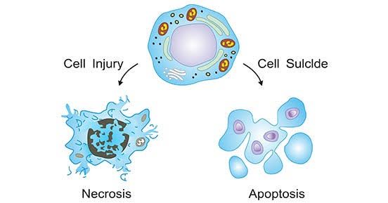 COMMON SIGNS OF CELL INJURY EVERYONE SHOULD KNOW COMMON SIGNS OF CELL INJURY EVERYONE SHOULD KNOW