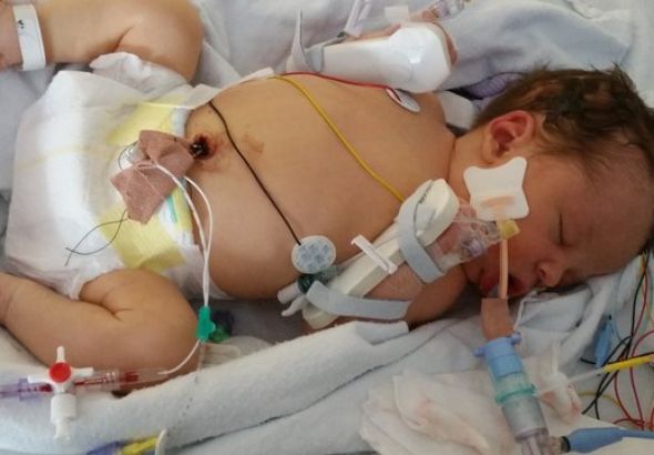 CLINICAL OVERVIEW OF NEONATAL BACTERIAL MENINGITIS: KEY INSIGHTS AND UNDERSTANDING