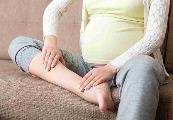 LOWER-EXTREMITY EDEMA DURING LATE PREGNANCY: ETIOLOGY, EVALUATION, AND TREATMENT