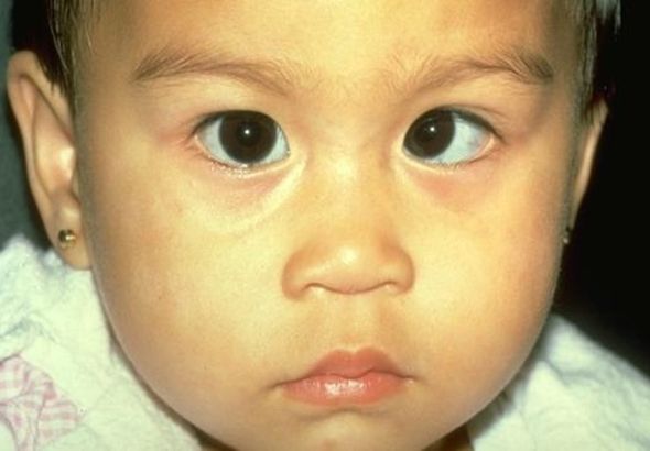 NAVIGATING AMBLYOPIA WITH PARENTS AND VISION-CARE EXPERTS