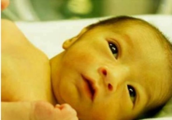 UNDERSTANDING NEONATAL CHOLESTASIS: A CLINICAL OVERVIEW