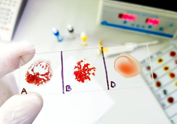 DISCOVER THE DIFFERENT BLOOD GROUPS AND THEIR IMPORTANCE