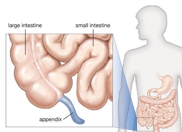 WHAT’S THE VERMIFORM APPENDIX AND WHY DO WE HAVE IT