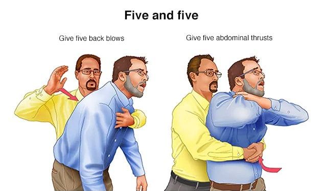 EMERGENCY AID: PERFORMING ABDOMINAL THRUSTS FOR CHOKING ADULTS