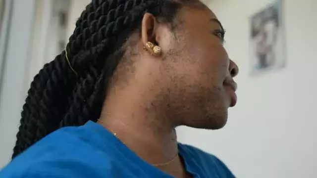 COMPREHENSIVE INSIGHTS INTO PCOS AND ANDROGEN EXCESS: FROM EARLY SIGNS TO EFFECTIVE TREATMENT