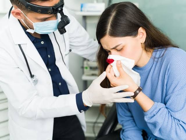 LEARN ABOUT EPISTAXIS: WHY NOSEBLEEDS OCCUR AND HOW TO RECOGNIZE THEM