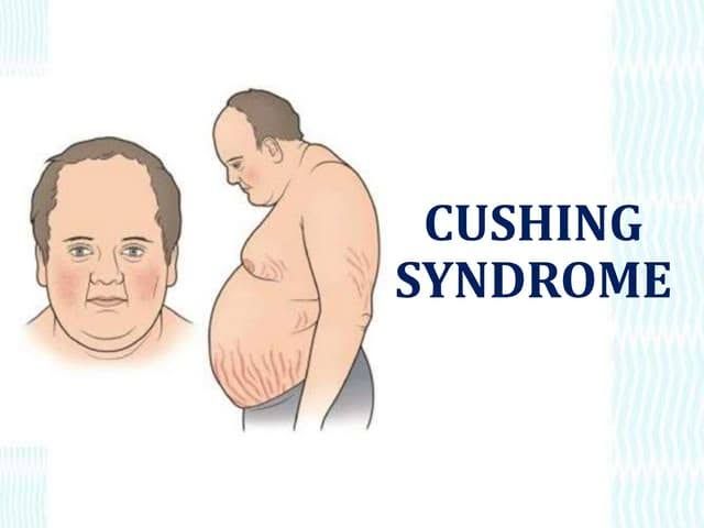 CUSHING’S SYNDROME DIAGNOSIS: TESTS, PROCEDURES, AND WHAT TO EXPECT