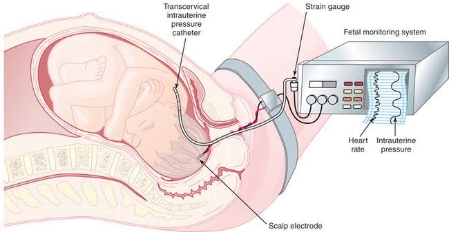 ENHANCING INTRAPARTUM FETAL SURVEILLANCE: KEY STRATEGIES FOR INTERPROFESSIONAL CARE