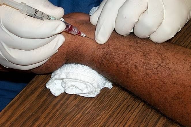 TOP CLINICAL SCENARIOS UTILIZING ARTERIAL BLOOD GAS ANALYSIS TOP CLINICAL SCENARIOS UTILIZING ARTERIAL BLOOD GAS ANALYSIS