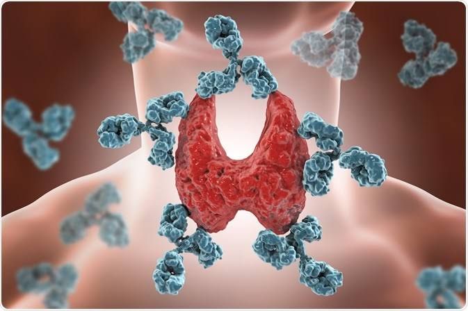 AUTOIMMUNE DISEASE MYTHS DEBUNKED: SEPARATING FACT FROM FICTION