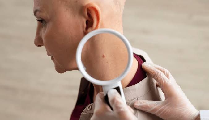 HOW LYMPHOMAS ARE DIAGNOSED AND TREATED