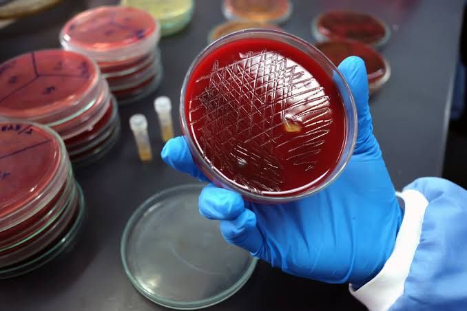 WHY BLOOD CULTURES ARE IMPORTANT IN DIAGNOSING INFECTIONS WHY BLOOD CULTURES ARE IMPORTANT IN DIAGNOSING INFECTIONS