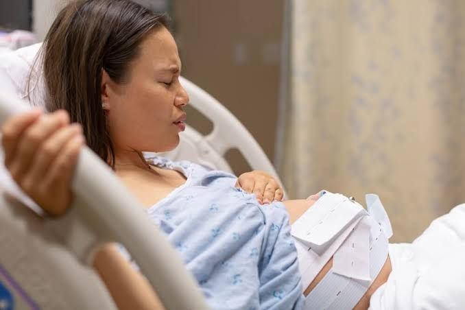 INDUCTION OF LABOR