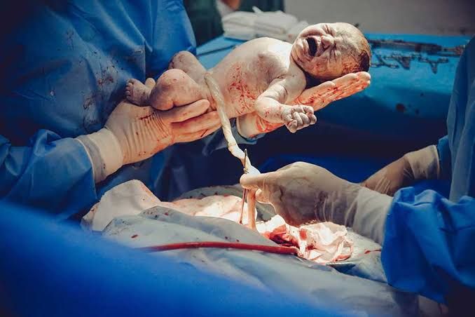 EMERGENT CAESAREAN DELIVERY MANAGEMENT: KEY STRATEGIES FOR IMPROVED OUTCOMES