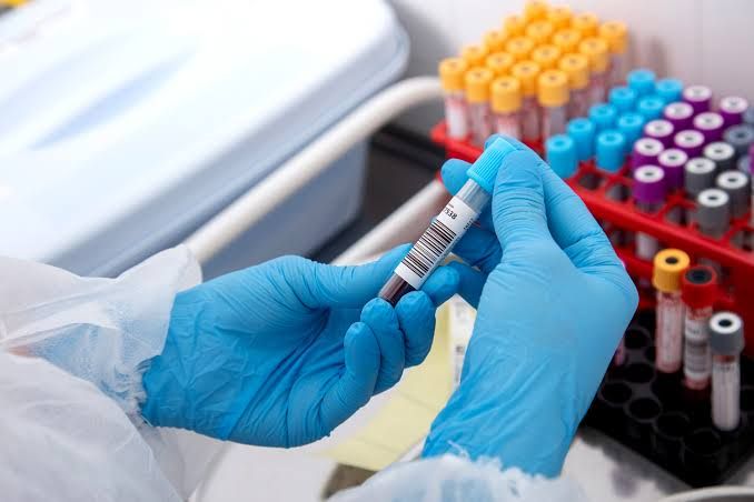 WHY CARDIAC ENZYMES AND PROTEINS HELP DETECT HEART ISSUES