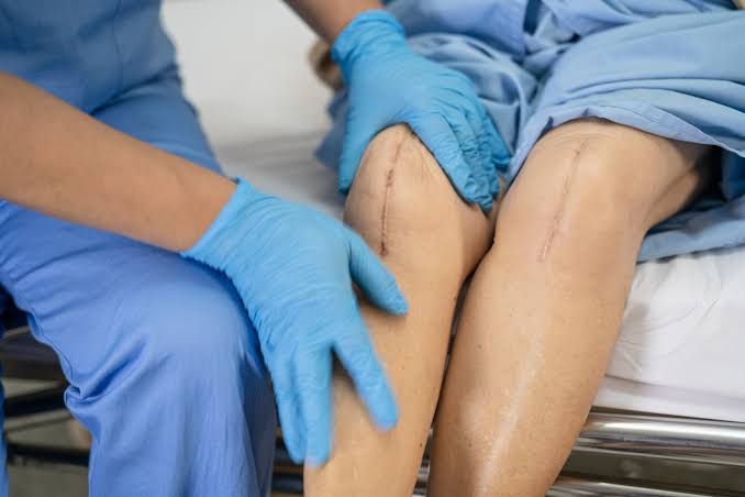 HEALING TIMES FOR SURGICAL WOUNDS AND COMMON ISSUES
