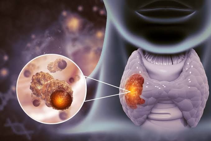 THYROID GLAND AND THYROGLOSSAL DISORDERS THYROID GLAND AND THYROGLOSSAL DISORDERS