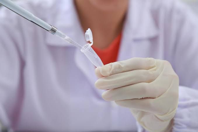 DNA EXTRACTION AND QUANTITATION FROM FORENSIC SAMPLES DNA EXTRACTION AND QUANTITATION FROM FORENSIC SAMPLES