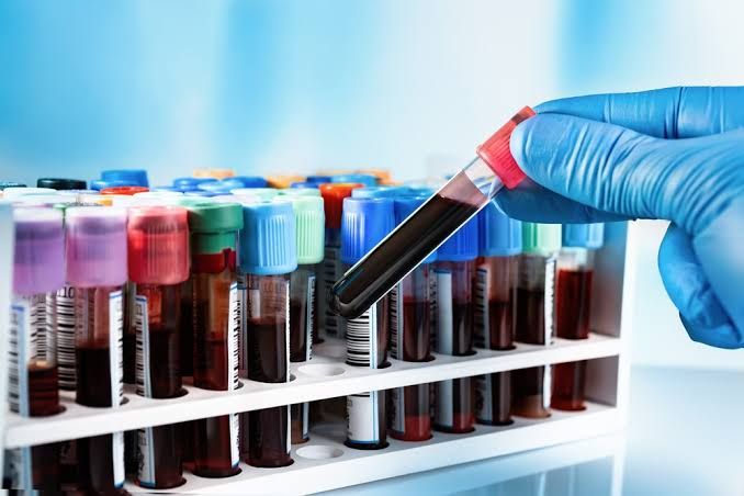 SAMPLE COLLECTION AND PRESERVATION