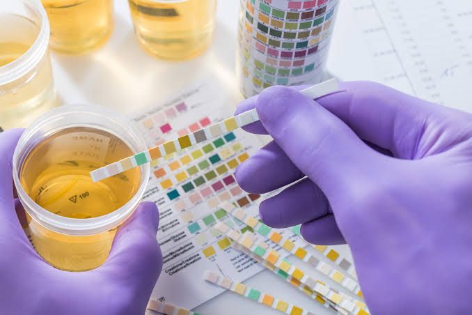 URINALYSIS AND URINE CULTURE URINALYSIS AND URINE CULTURE