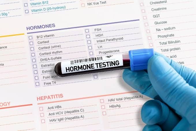 UNDERSTANDING LABORATORY TESTS USED IN ENDOCRINOLOGY UNDERSTANDING LABORATORY TESTS USED IN ENDOCRINOLOGY