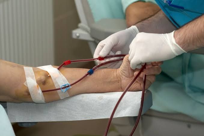 MANAGING VASCULAR ACCESS FOR DIALYSIS PATIENTS