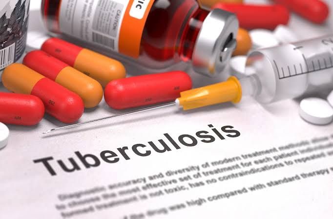 EFFECTIVE TREATMENT OPTIONS FOR TUBERCULOSIS EFFECTIVE TREATMENT OPTIONS FOR TUBERCULOSIS