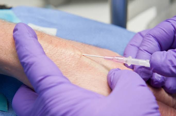 INTRAVENOUS INJECTION PROCEDURE: STEP-BY-STEP INTRAVENOUS INJECTION PROCEDURE: STEP-BY-STEP