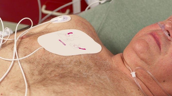 WHEN AND WHY TO USE TRANSCUTANEOUS PACING IN ADULT CARDIAC CARE