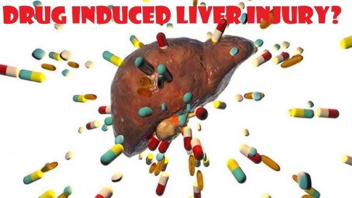 HOW CAN DRUG-INDUCED LIVER INJURY BE PREVENTED